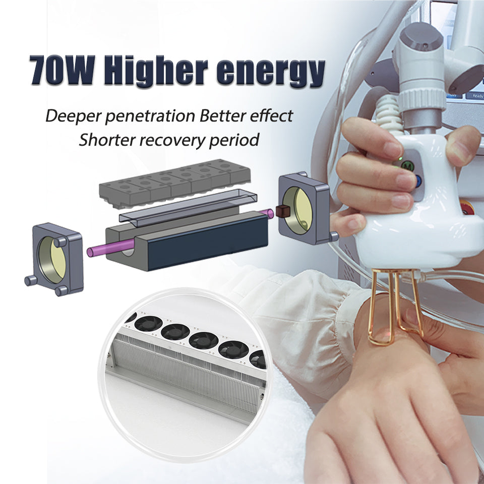 Professional 50w 70w Co2 Fractional Laser Surfacing Machine Price