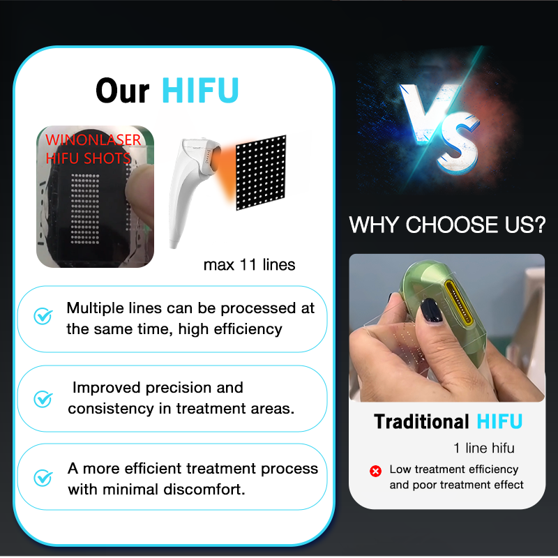 WINKONLASER 2025 Portable HIFU Machine  3D 4D 5D 7D 8D Painless Face Lifting & Body Slimming Device CE Certified