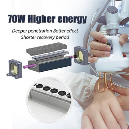 Professional 50w 70w Co2 Fractional Laser Surfacing Machine Price